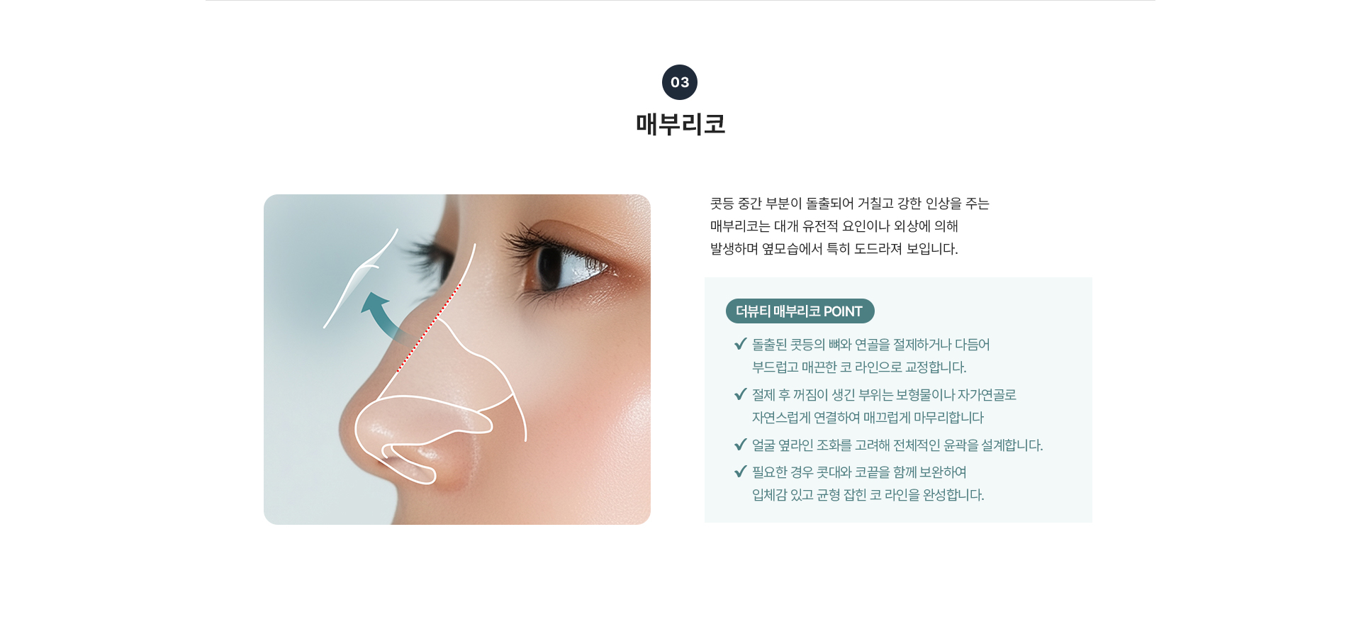 코교정 상세07