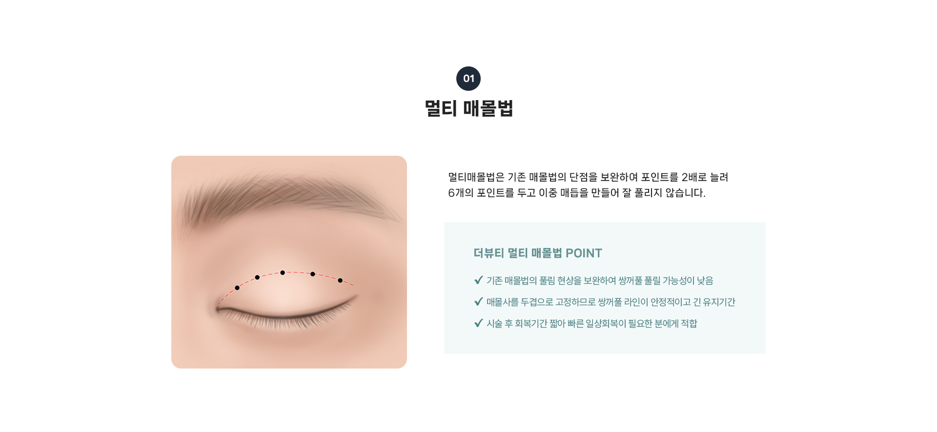 쌍꺼풀 상세04