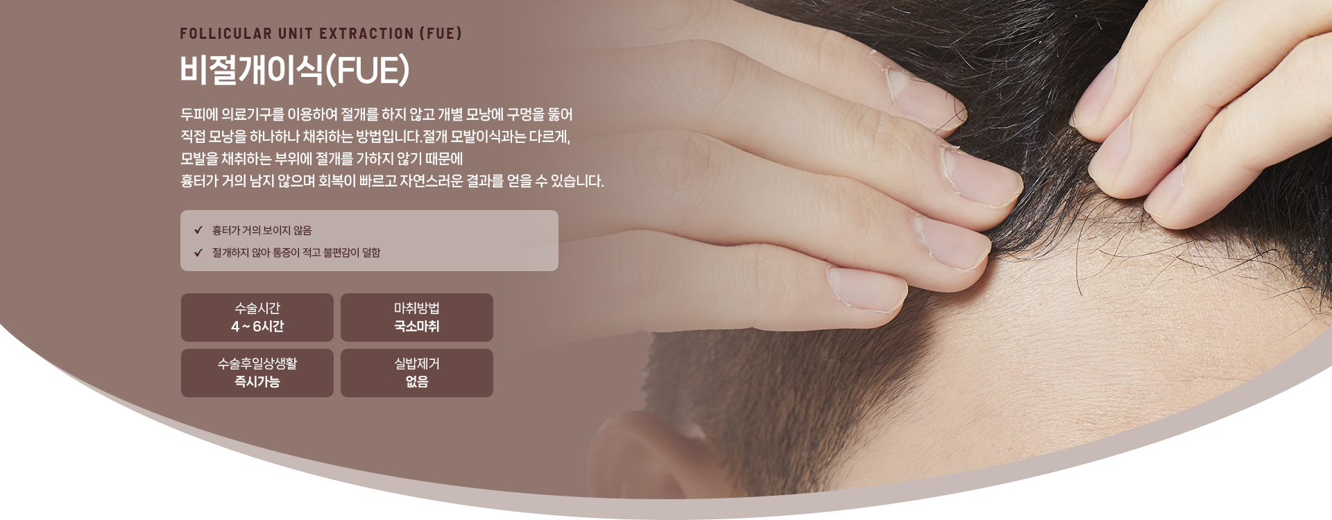 비절개이식 상세01