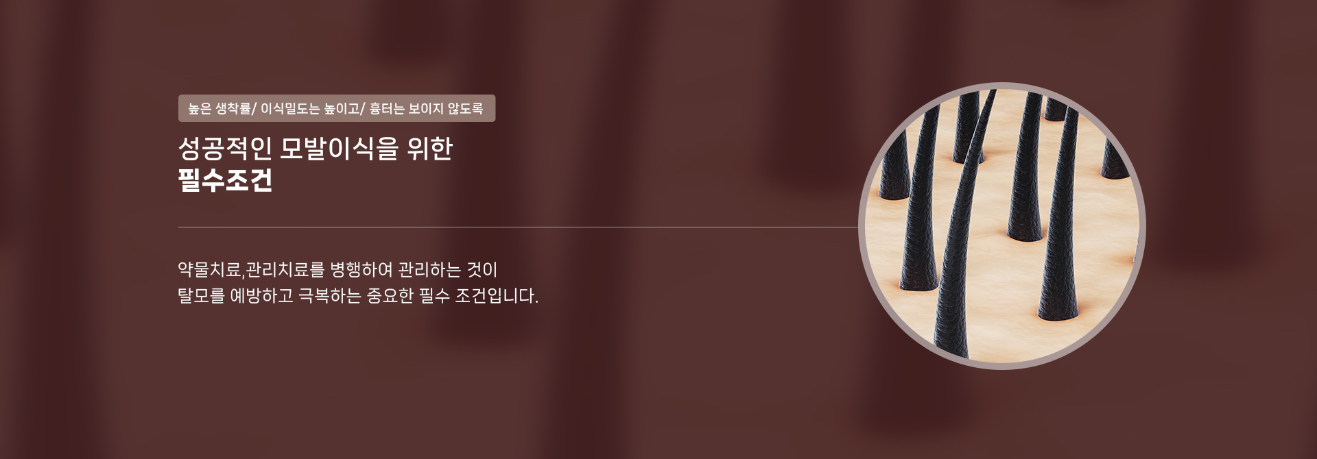 비절개이식 상세04