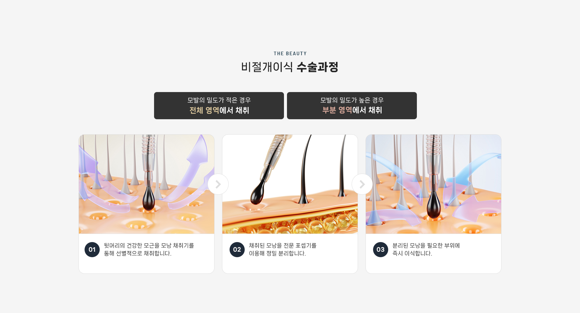 비절개이식 상세06