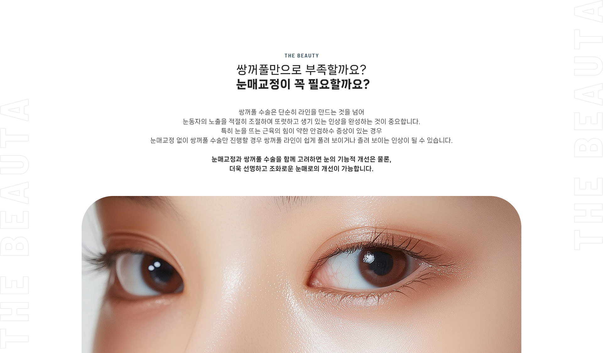 눈매교정 상세05