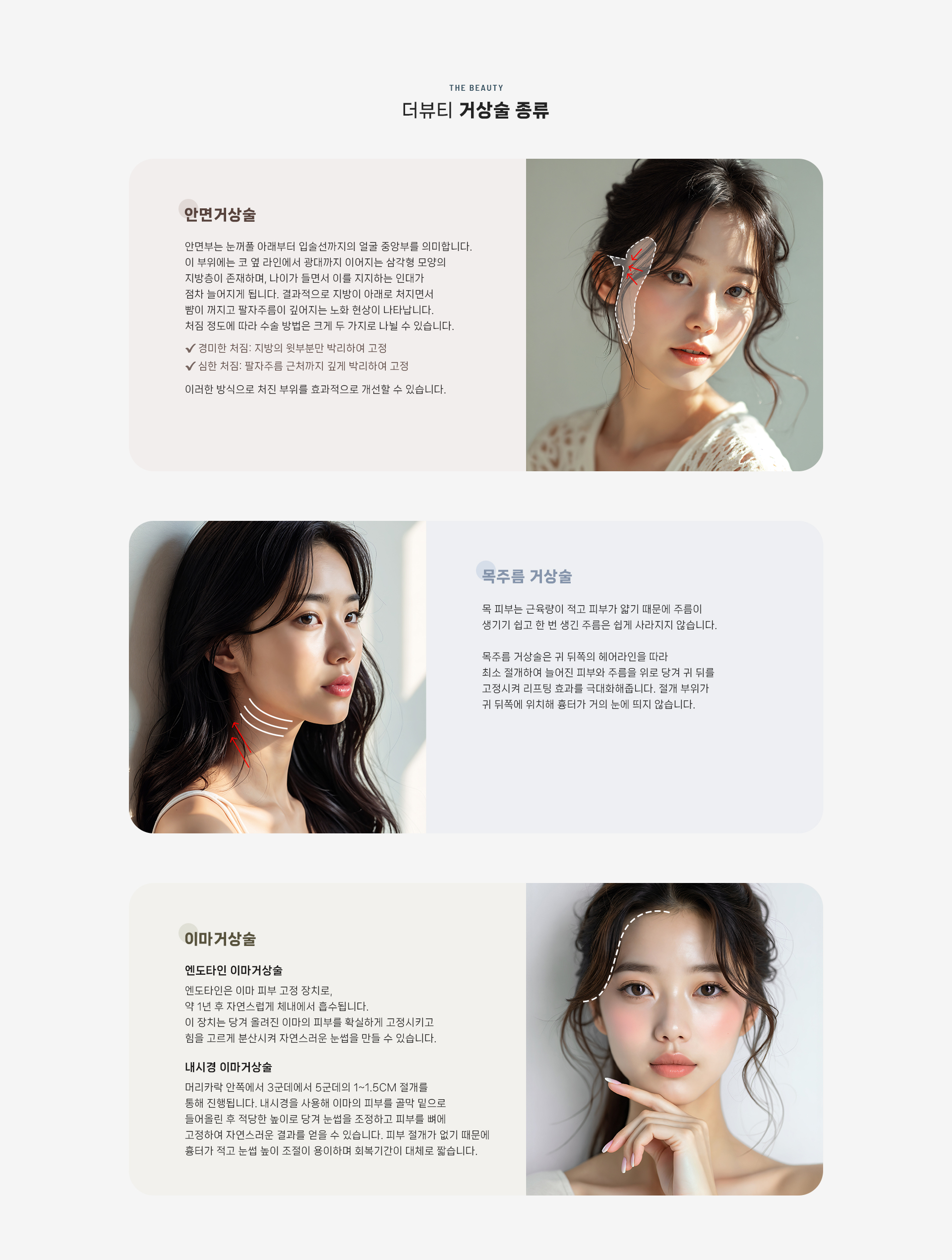 안면거상 상세05