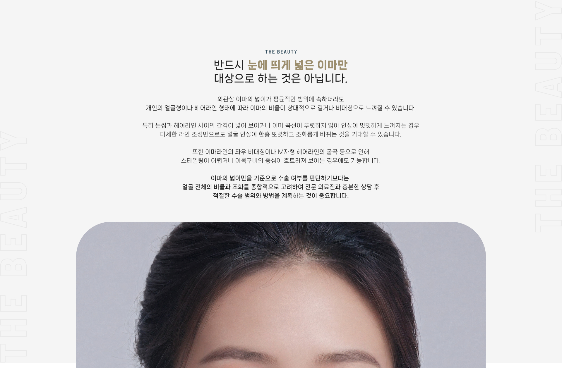 이마축소술 상세03