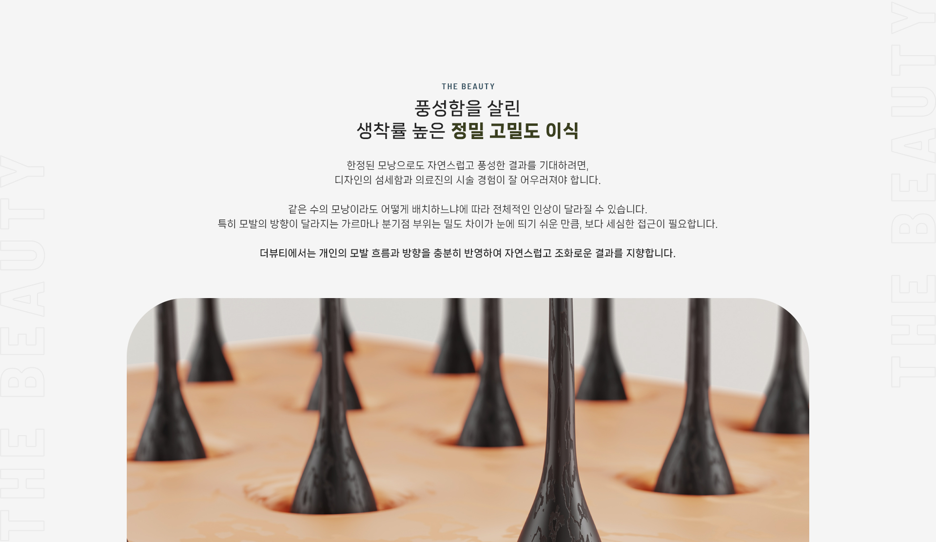 남성모발이식 상세03