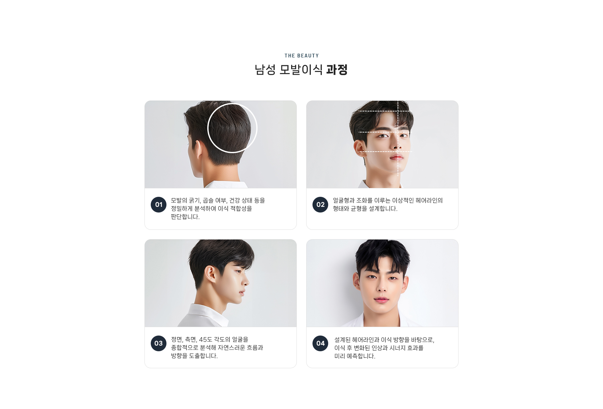 남성모발이식 상세04