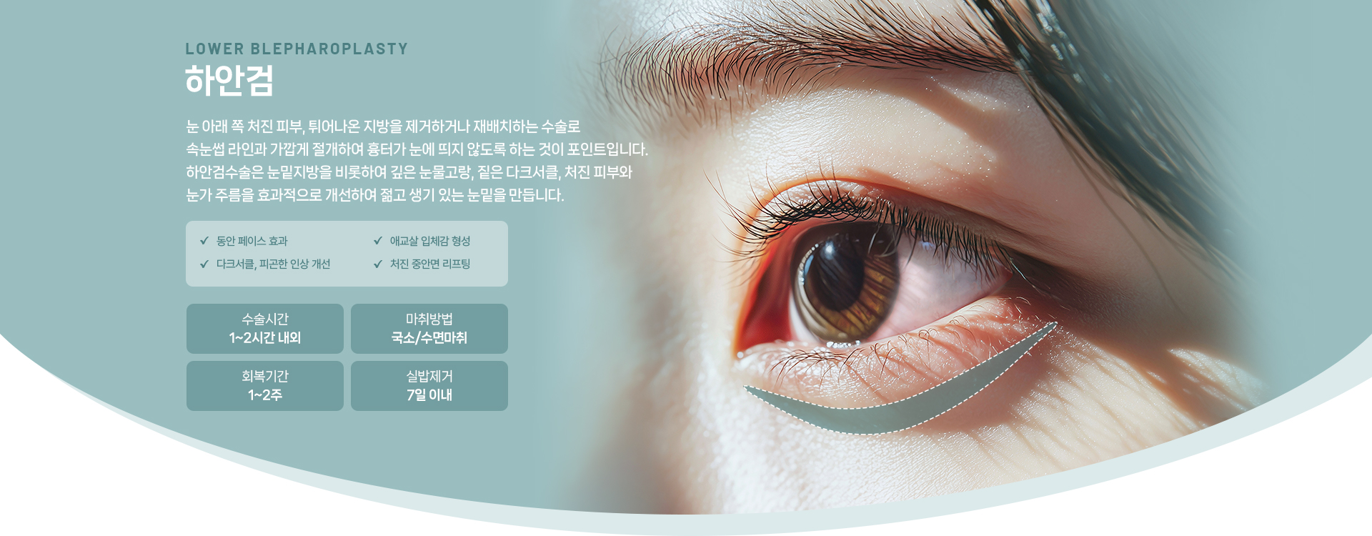 하안검 상세01