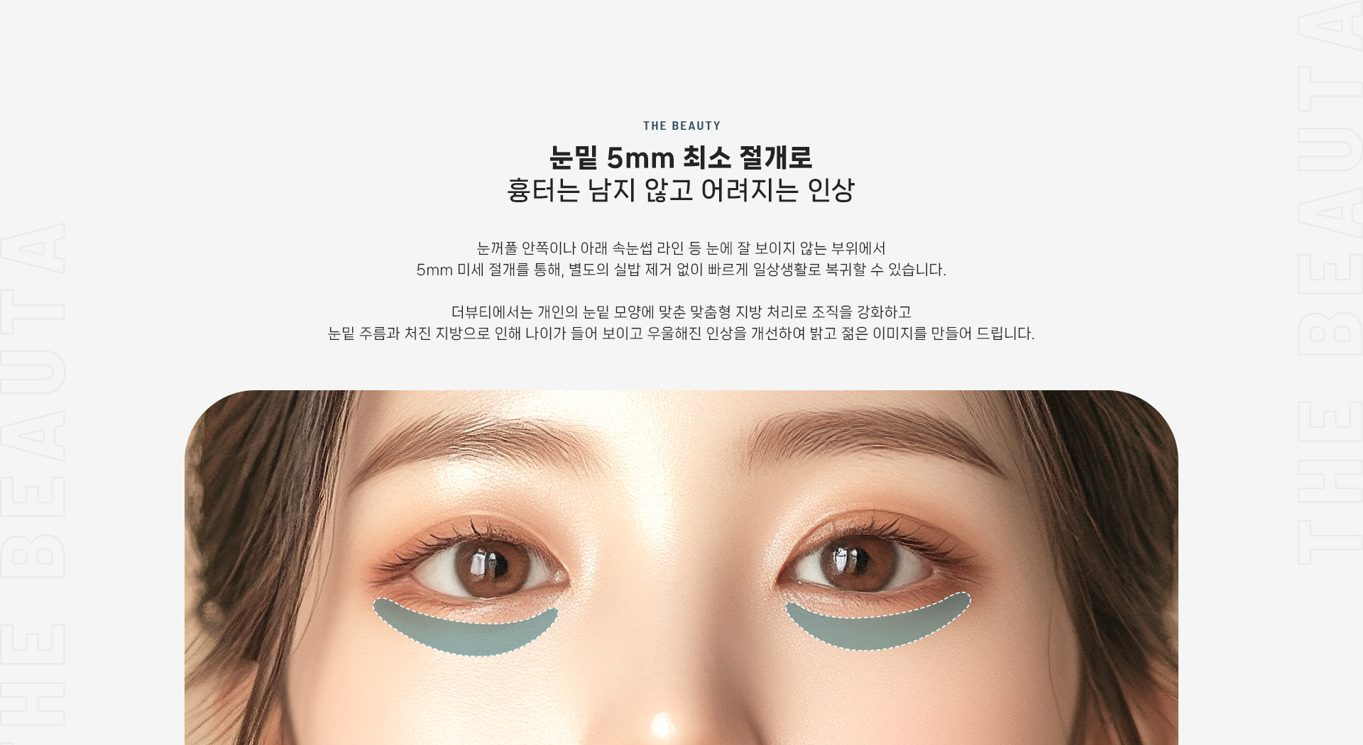 하안검 상세03