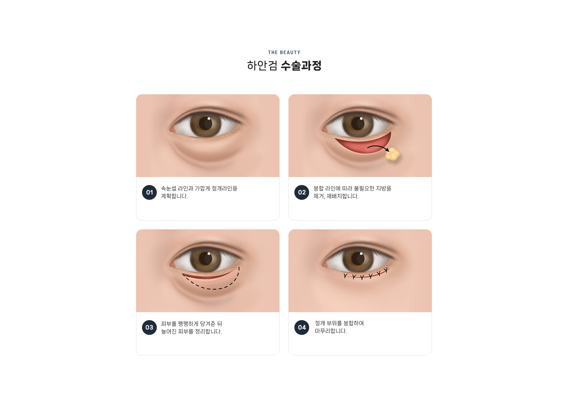 하안검 상세06