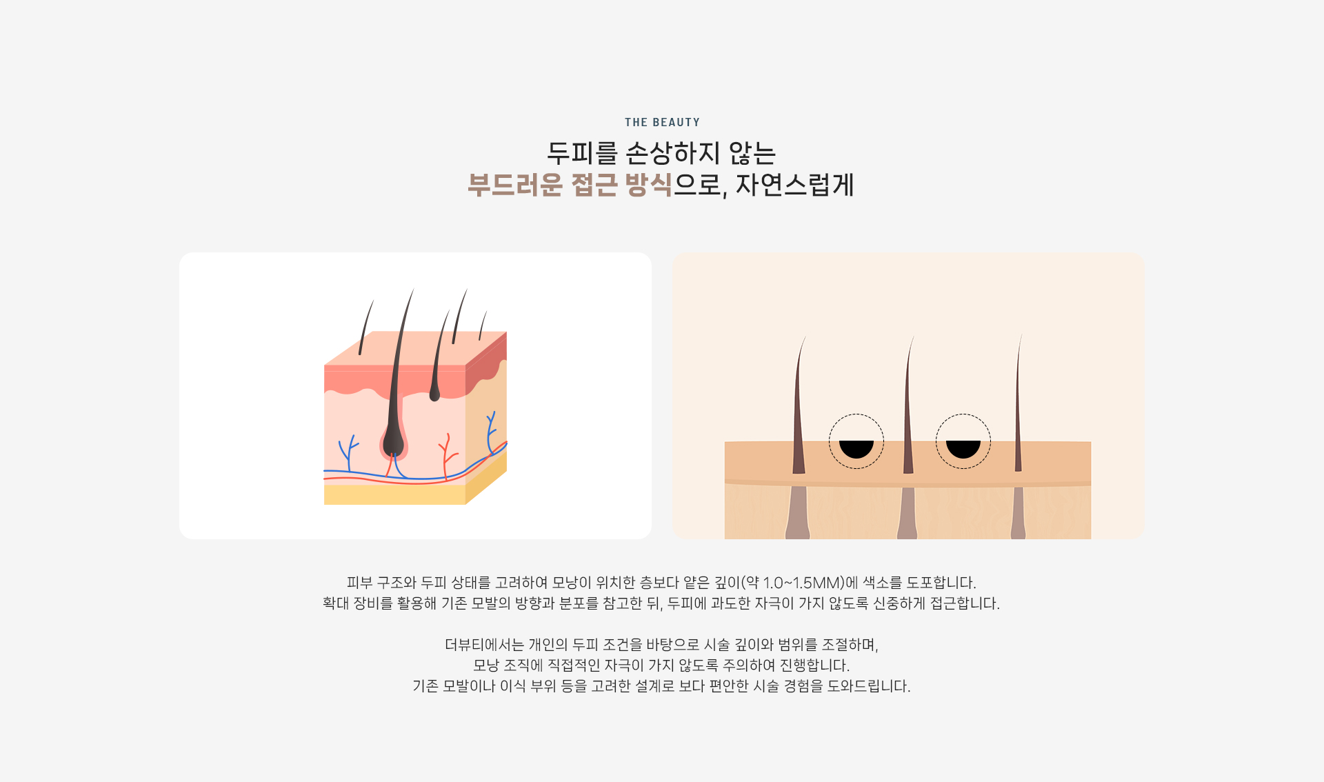 두피문신 상세03