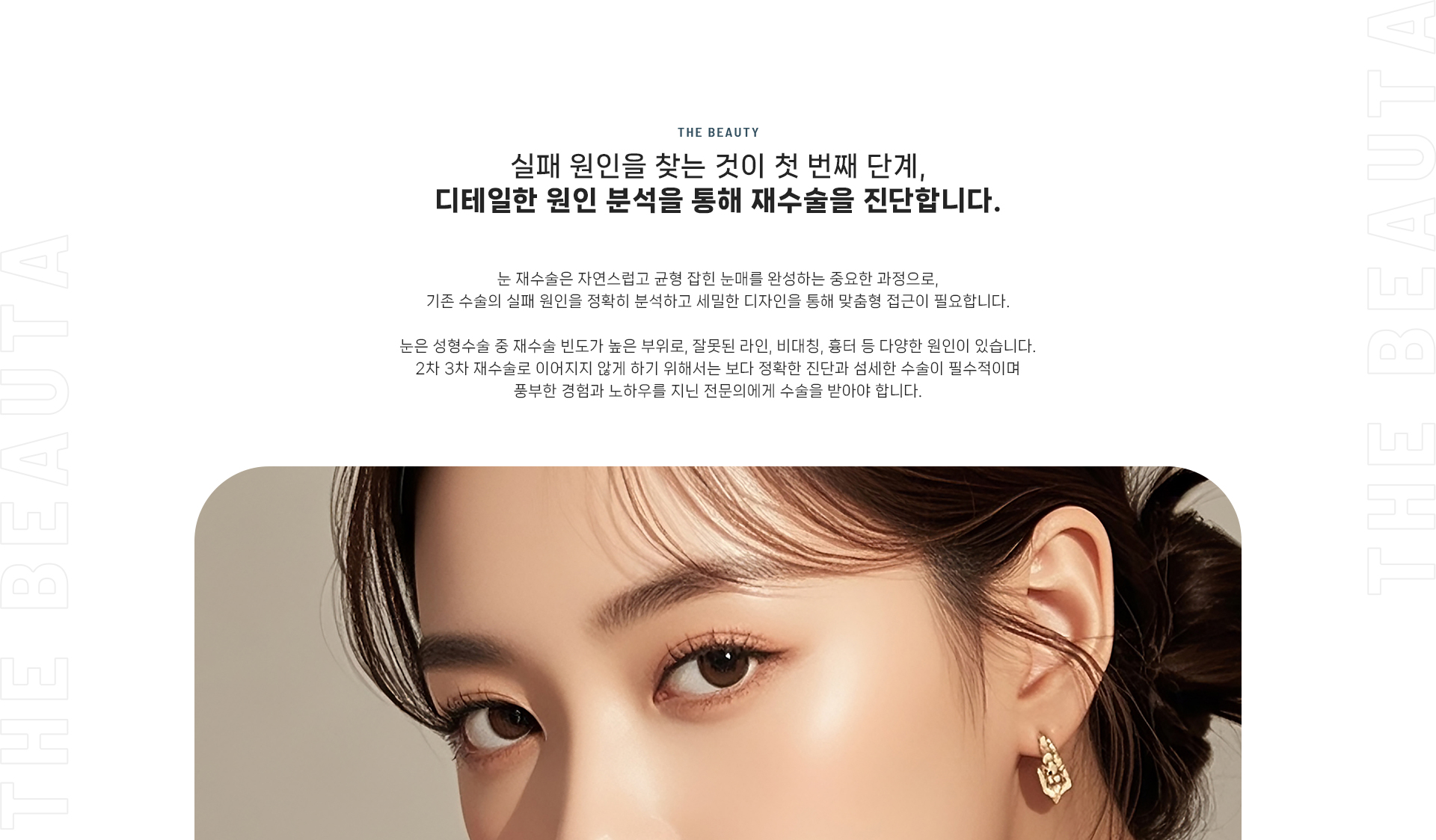 눈재수술 상세02