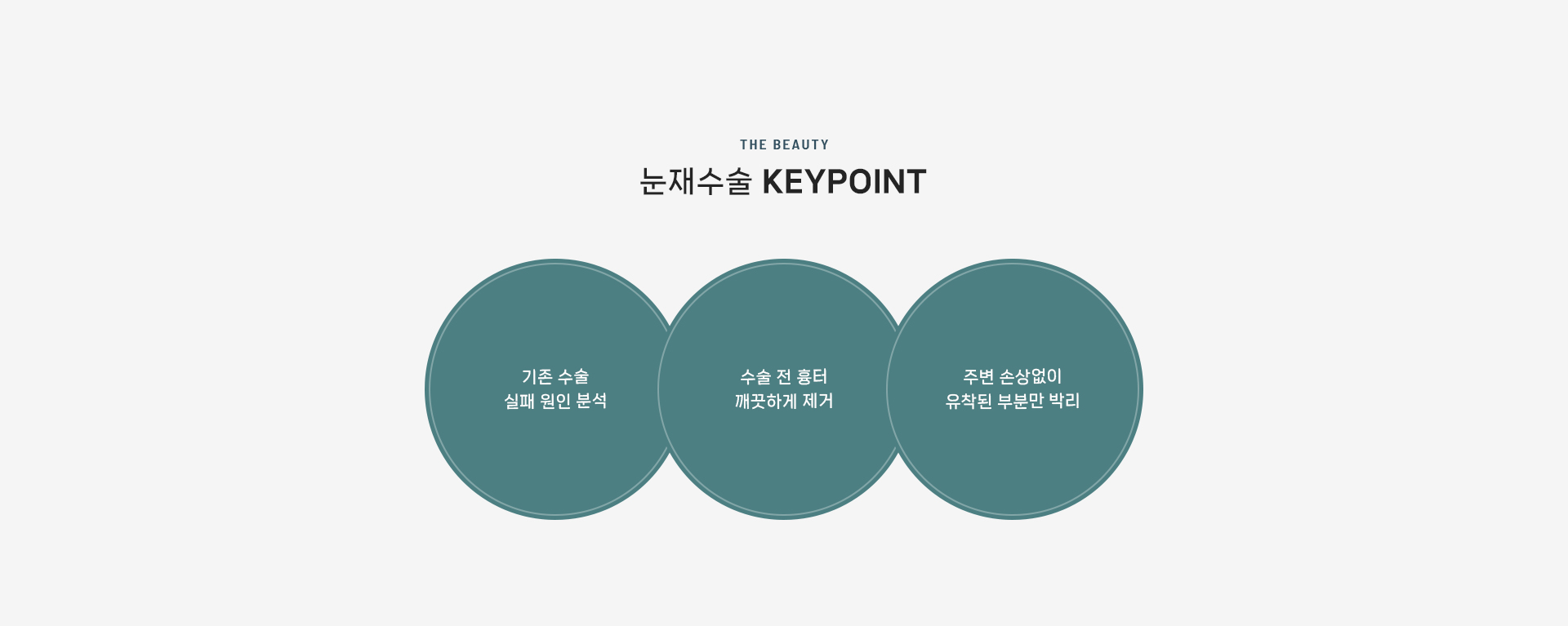 눈재수술 상세07