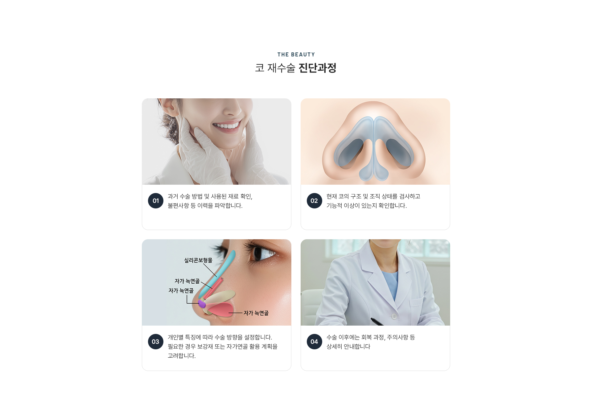 코재수술 상세06