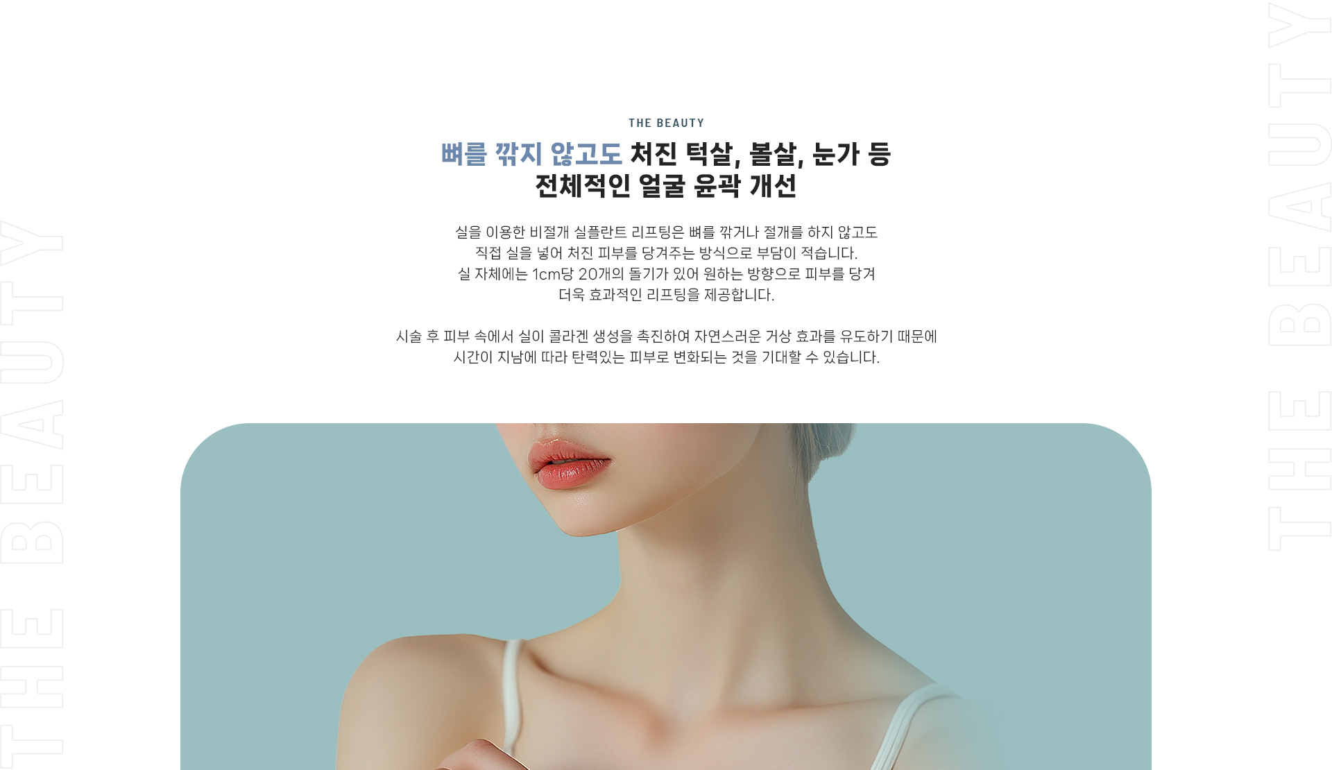 실플란트 상세05