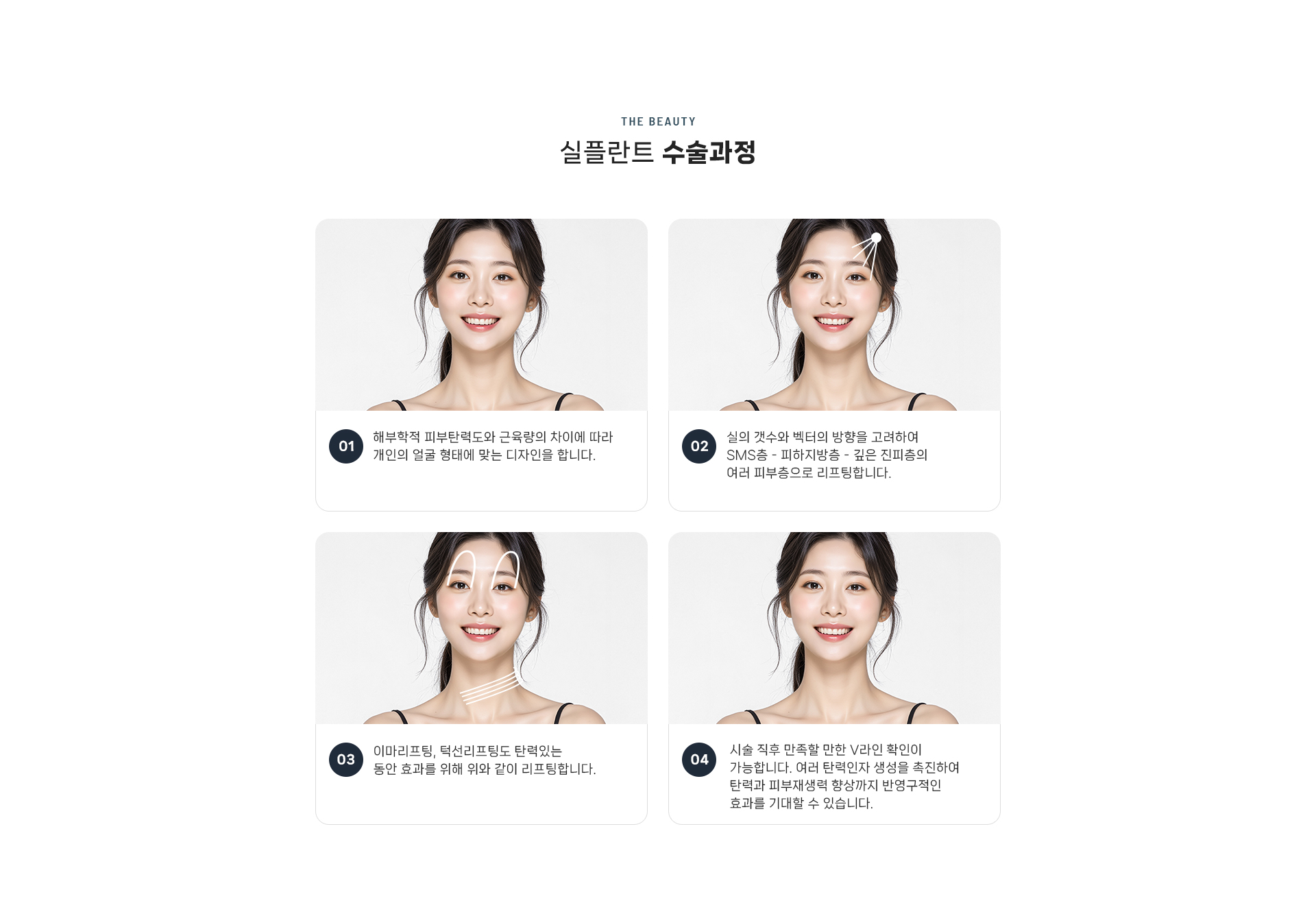 실플란트 상세07