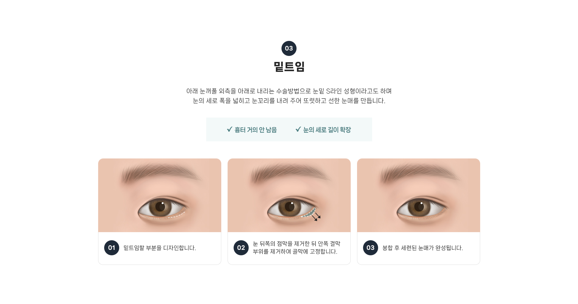 트임 상세08
