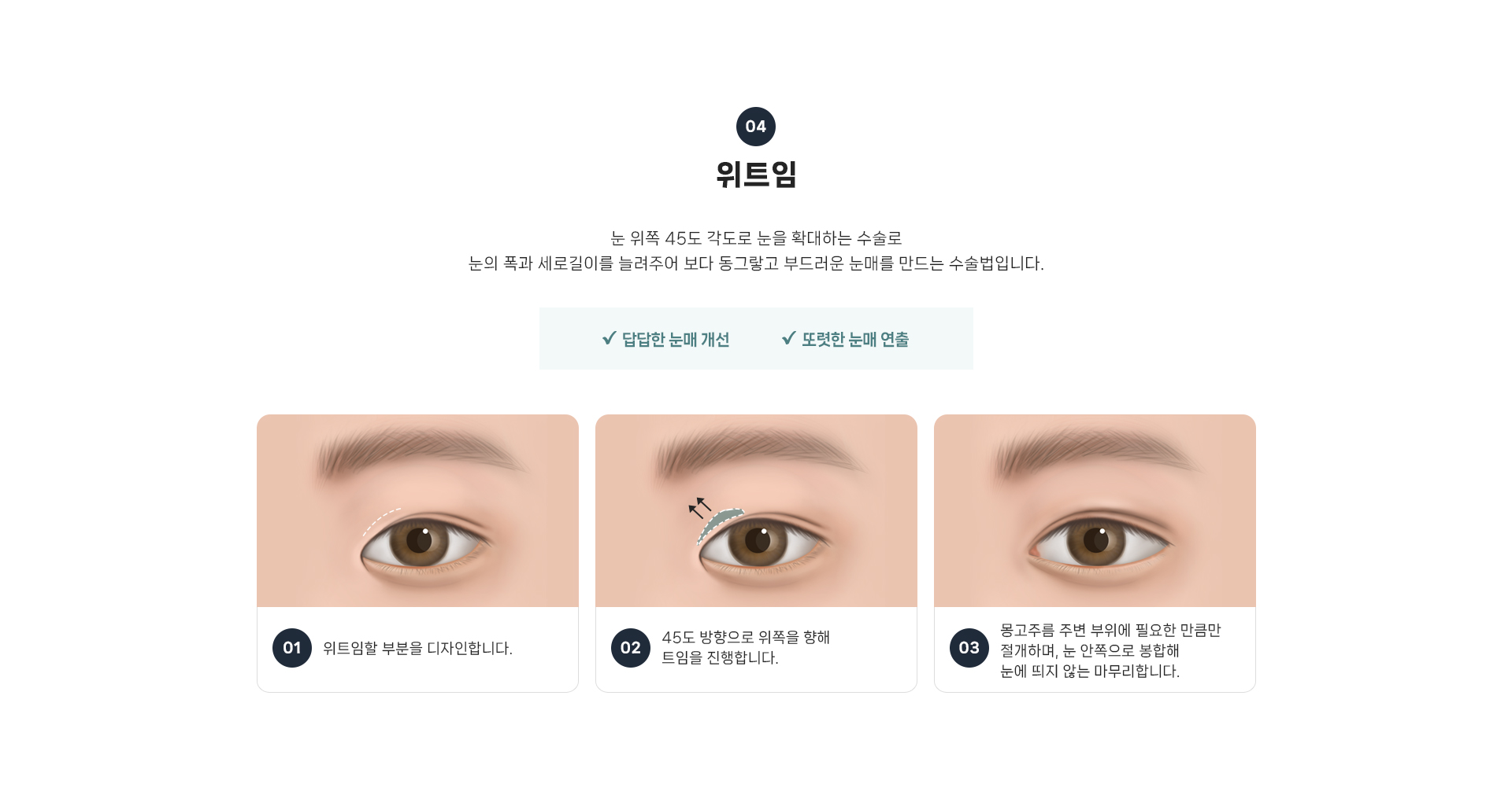 트임 상세10