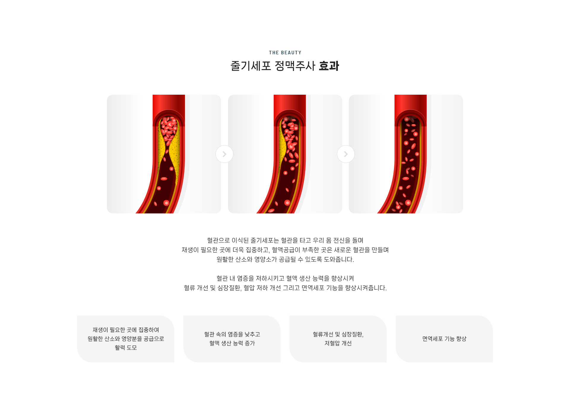 줄기세포 셀테라피 상세05