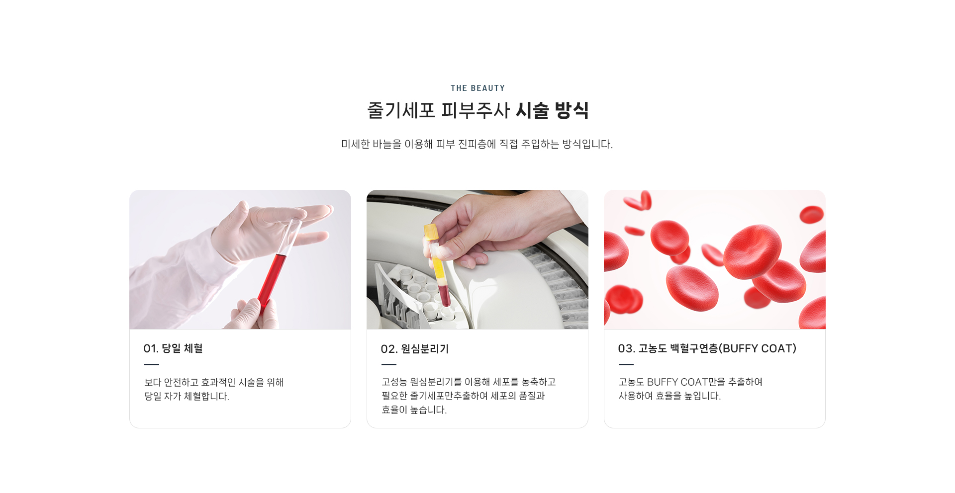 줄기세포 셀테라피 상세09