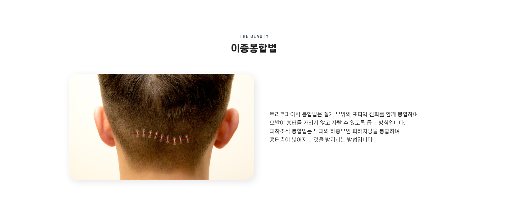 절개이식 상세04