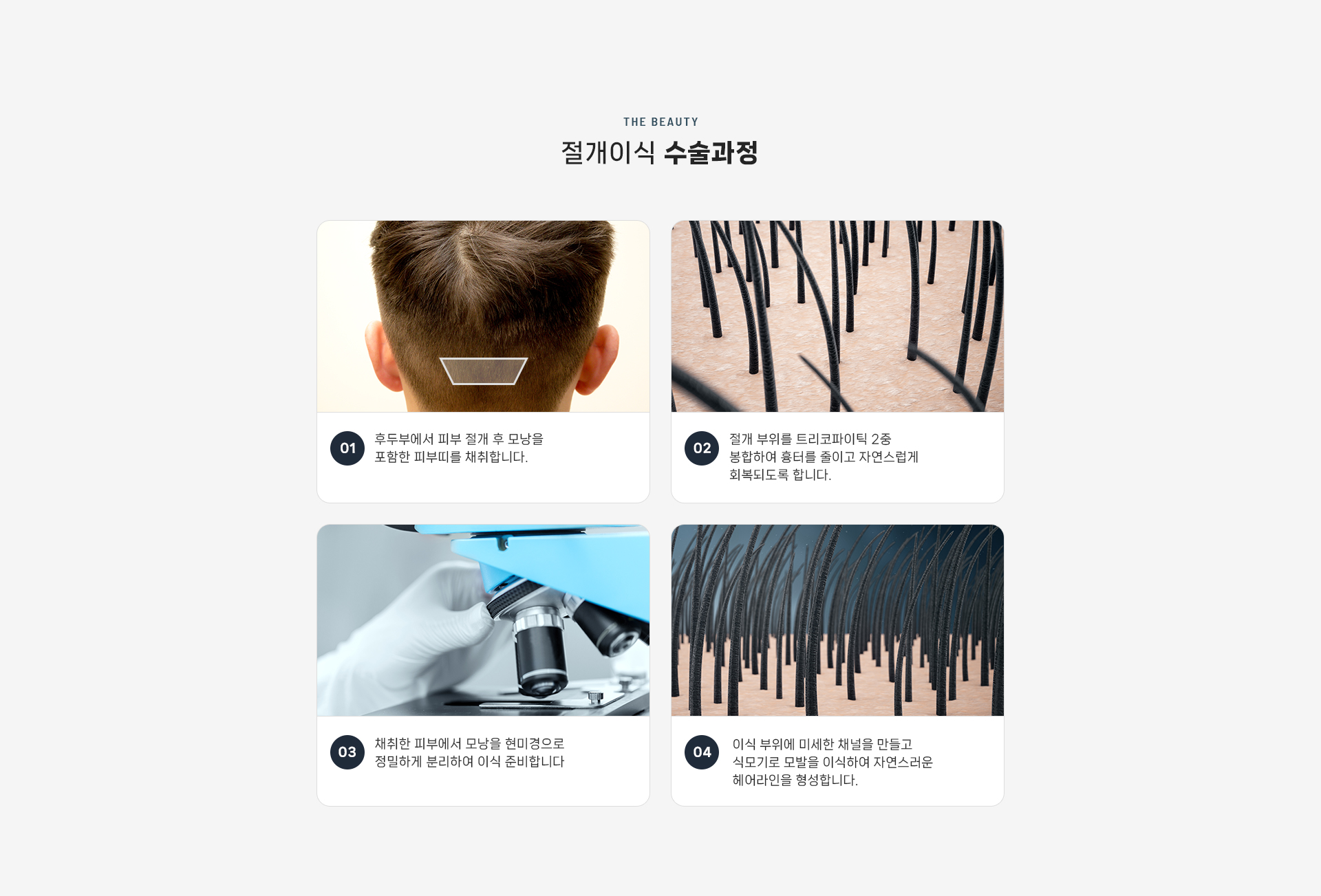 절개이식 상세06