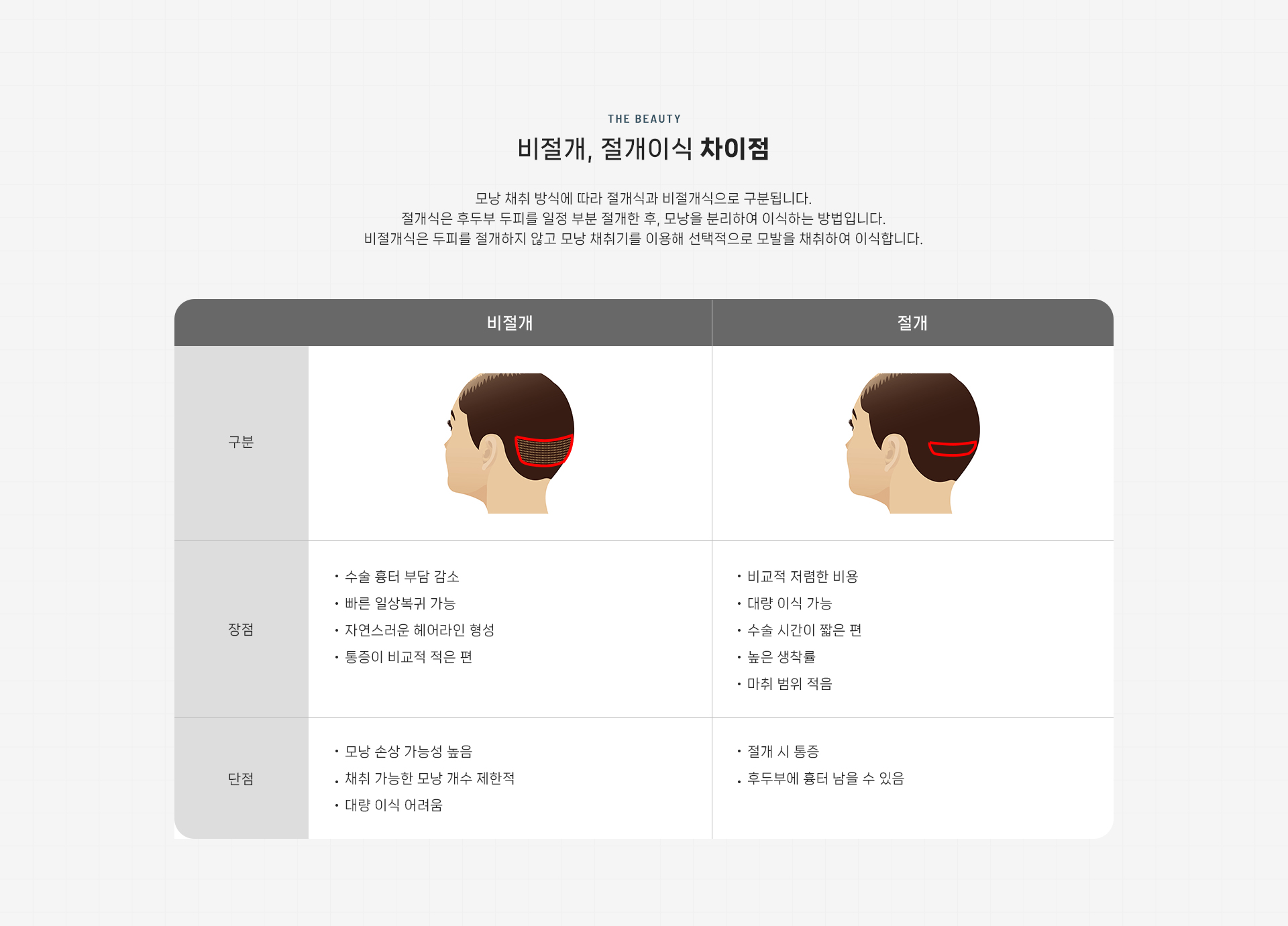 절개이식 상세08