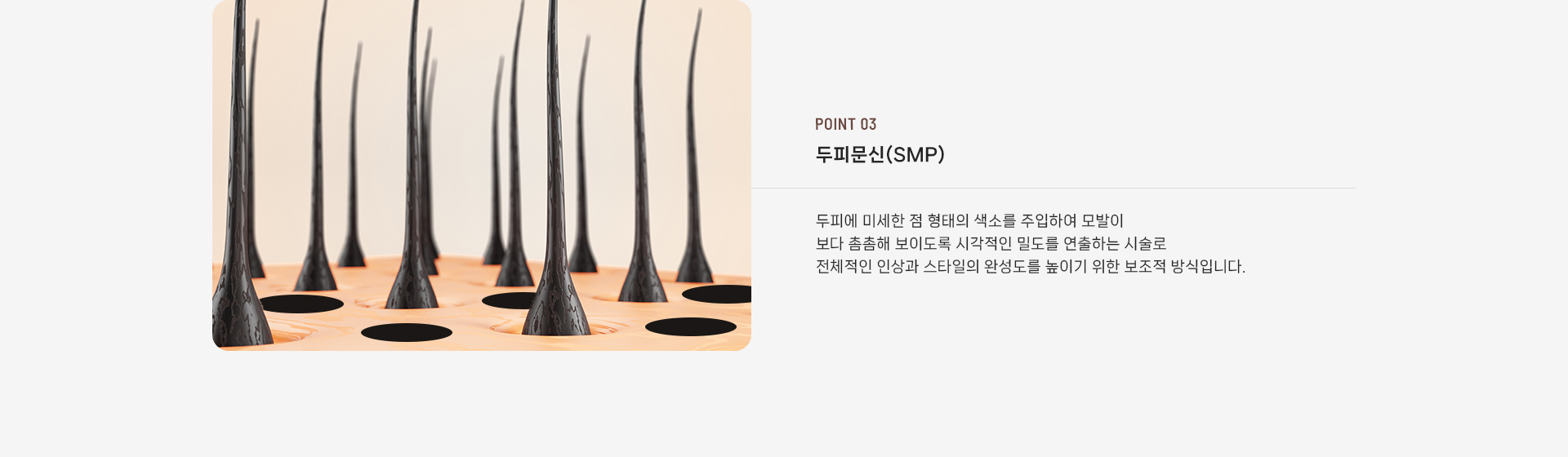 탈모치료/두피케어 상세03