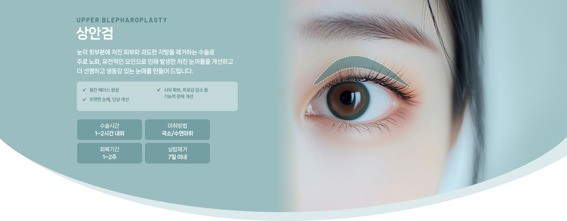 상안검 상세01