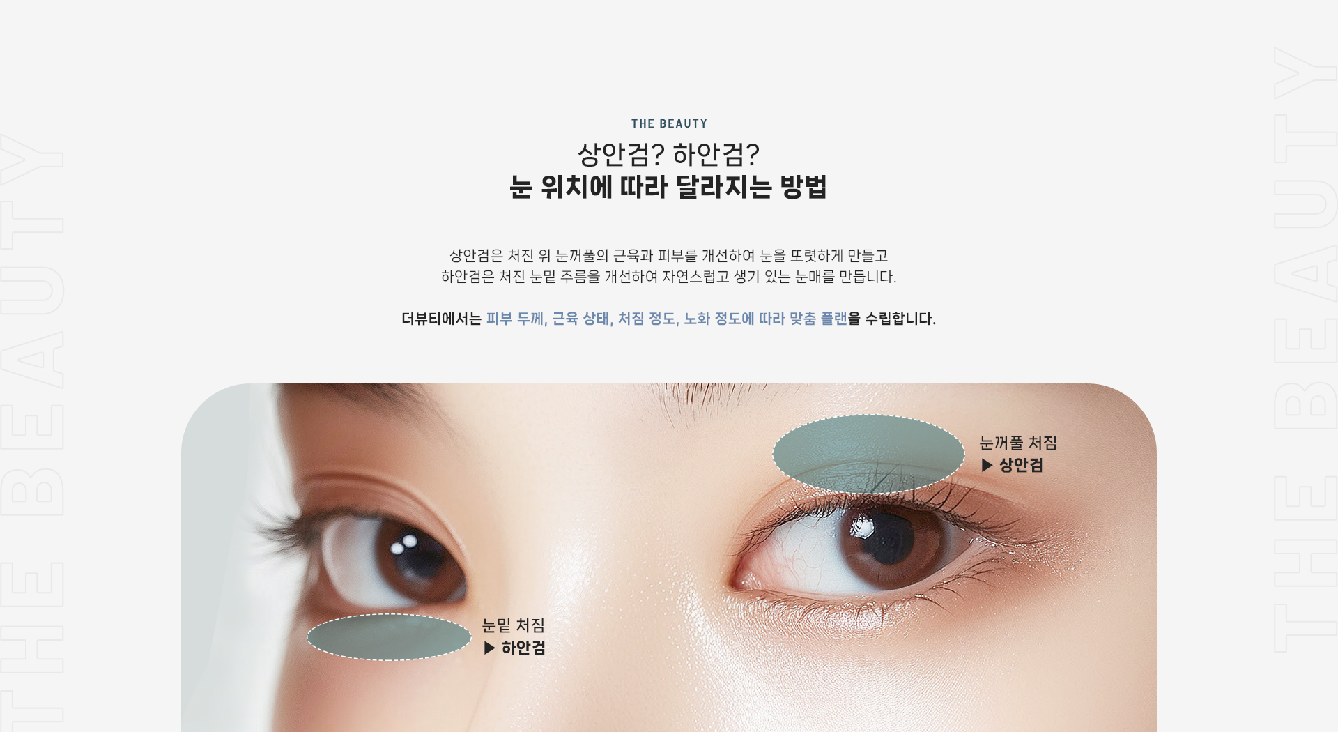 상안검 상세03